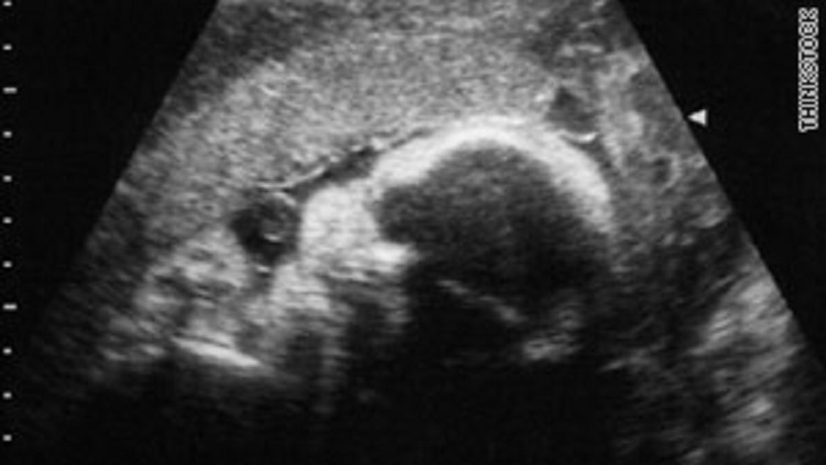 sonogram_181796