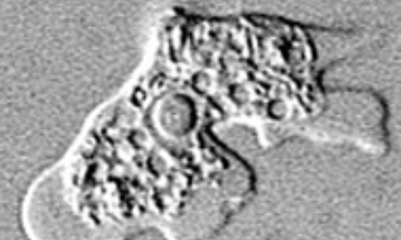 brain eating amoeba naegleria fowleri_222953