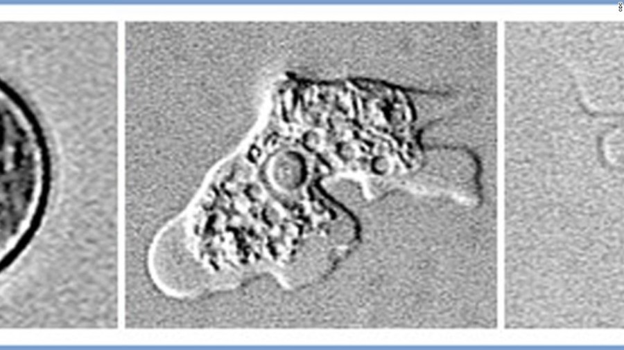 130729155831-naegleria-fowleri-amoeba-horizontal-large-gallery_224074