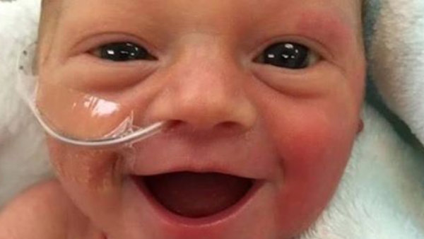 r-smiling-preemie-web_bkg__439634